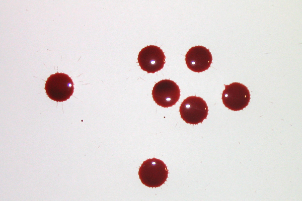 Bloodstain Example - Drip Stain