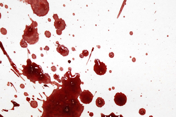 Bloodstain Example - Expirated Blood