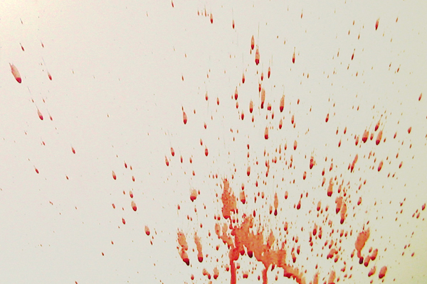 Bloodstain Example - Medium Velocity Impact Spatter (MVIS) Bloodstain Example - Medium Velocity Impact Spatter (MVIS)