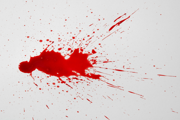 Bloodstain Example - Bloodstain pattern